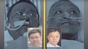 Incredibil! Infectați cu noul coronavirus, doi medici chinezi s-au trezit cu pielea închisă la culoare! Explicațiile specialiștilor