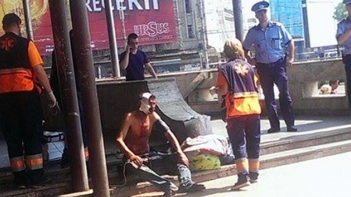 Imagini de cosmar! Politistii si medicii de pe ambulanta au incremenit cand l-au vazut pe acest barbat