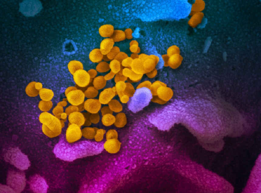 Virusul Covid-19, analizat la microscop