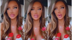 Bianca Drăgușanu, pusă la zid din cauza buzelor prea mari. Reacția neașteptată a vedetei: ”De asta mi-am făcut atâtea operații estetice”
