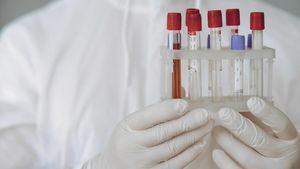 Analize și consultații gratuite în 2026. Cine poate beneficia fără să fie asigurat