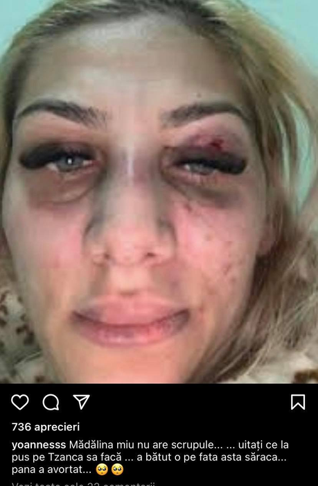 Yoannes, noi acuzații la adresa lui Tzancă Uraganu! „A bătut-o pe fata asta până a avortat”