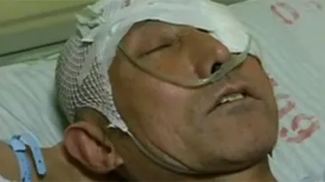 A avut un accident casnic si s-a dus de urgenta la spital! Ce au gasit medicii in craniul lui: Nu am simtit cand a intrat