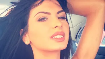 Madalina Pamfile s-a tunat dupa despartirea de iubit! Ce a patit din cauza unei interventii cu acid hialuronic