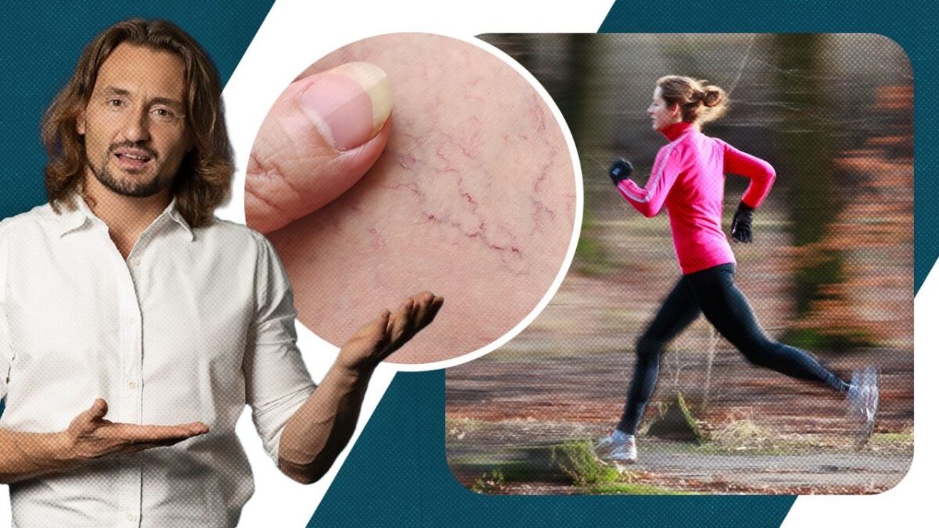 „Nu putem trata problemele venoase fără mișcare!” Dr. Cezar explică de ce activitatea fizică este esențială pentru circulatia sanguină