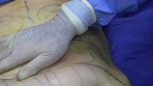 Liporexia, noua obsesie a femeilor care vor sa fie slabe!