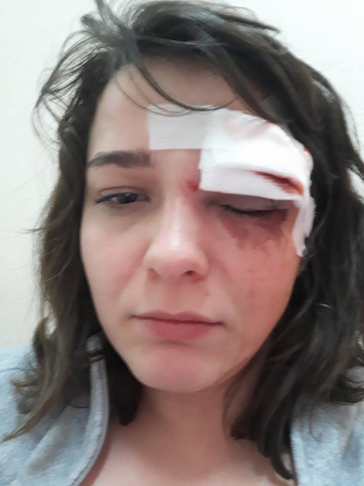 O tânără din București a fost bătută și jefuită în apropierea casei: „Am țipat după ajutor și l-am mușcat de mână”