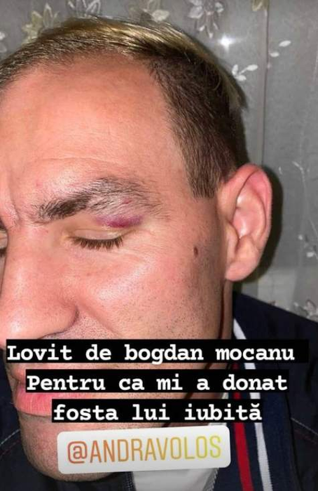 TikTokerul Costică susține că ar fi fost bătut de Bogdan Mocanu