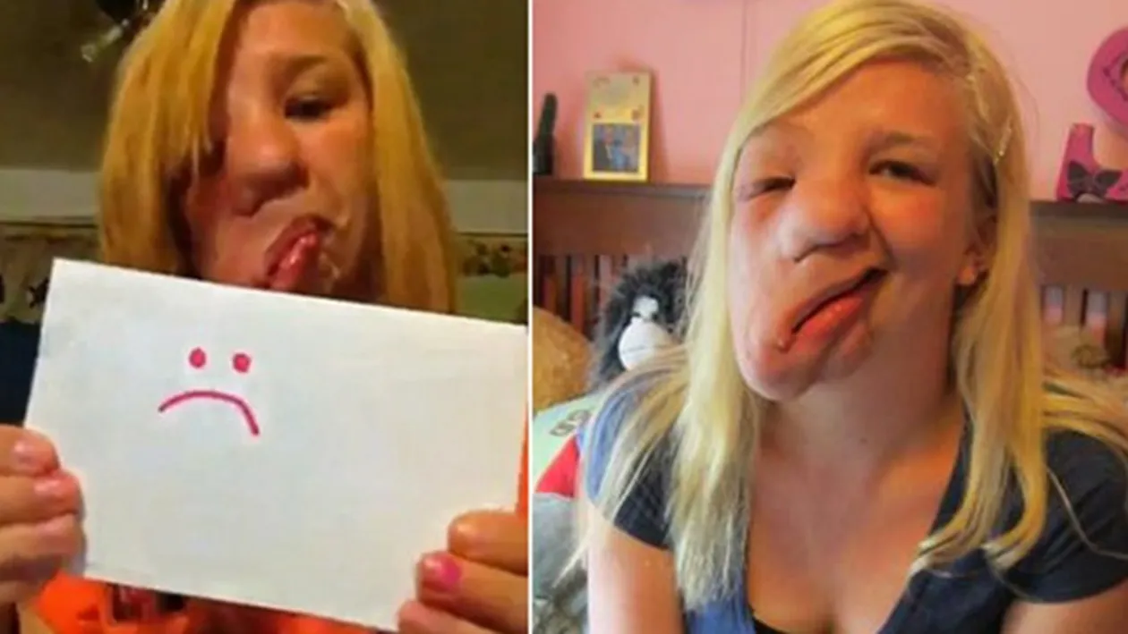 Imagini SOCANTE! Are doar 17 ani, dar arata ca un MONSTRU! O boala cumplita i-a distrus complet chipul