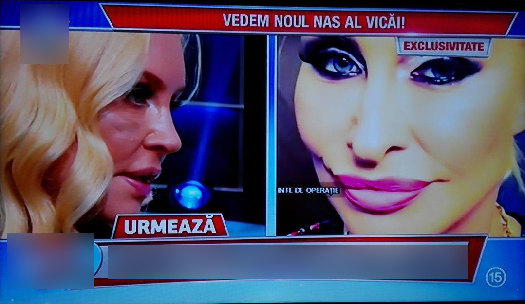 VICA BLOCHINA de nerecunoscut! Iată cum arată acum nasul ei proaspăt operat