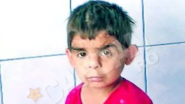 Un baietel din Iasi arata de patru ani, desi are zece! A golit frigiderele din spital de foame