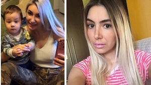 Prima imagine cu Sexy Brăileanca după ce și-a făcut intervenție estetică la nivelul feței