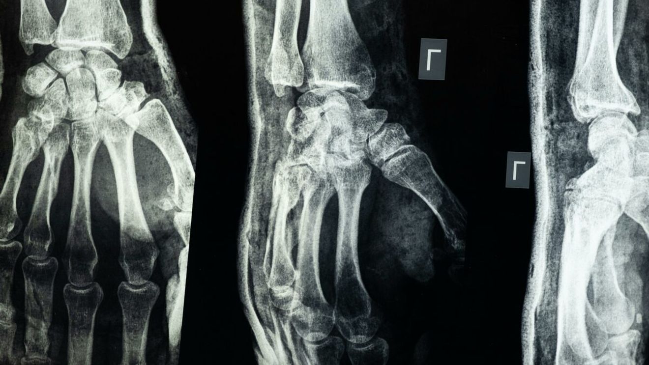 De ce se nasc bebelușii cu peste 300 de oase, dar adulții au doar 206. Explicația surprinzătoare a medicilor