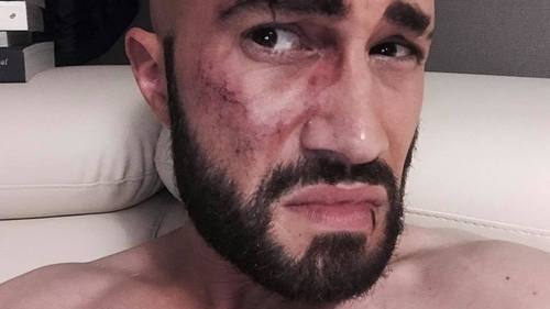 Mihai Bendeac, la un pas să fie omorât într-un club din Timișoara: “A fost pus la pământ…“