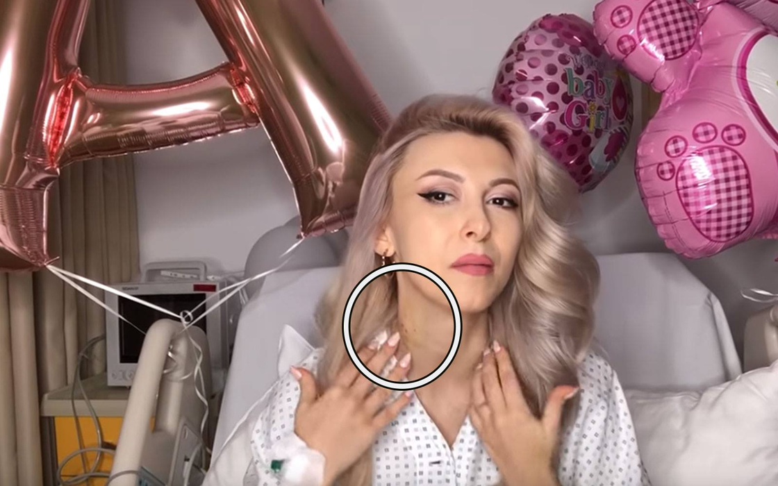 Andreea Bălan, plină de vânătăi! Lupta cu moartea i-a lăsat urme pe corp! Imagini greu de privit
