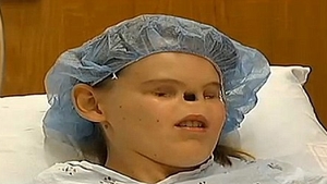 IMAGINI SOCANTE! Ea este adolescenta care s-a născut fără nas si fără ochi. După 17 de ani chin, medicii au decis să o opereze
