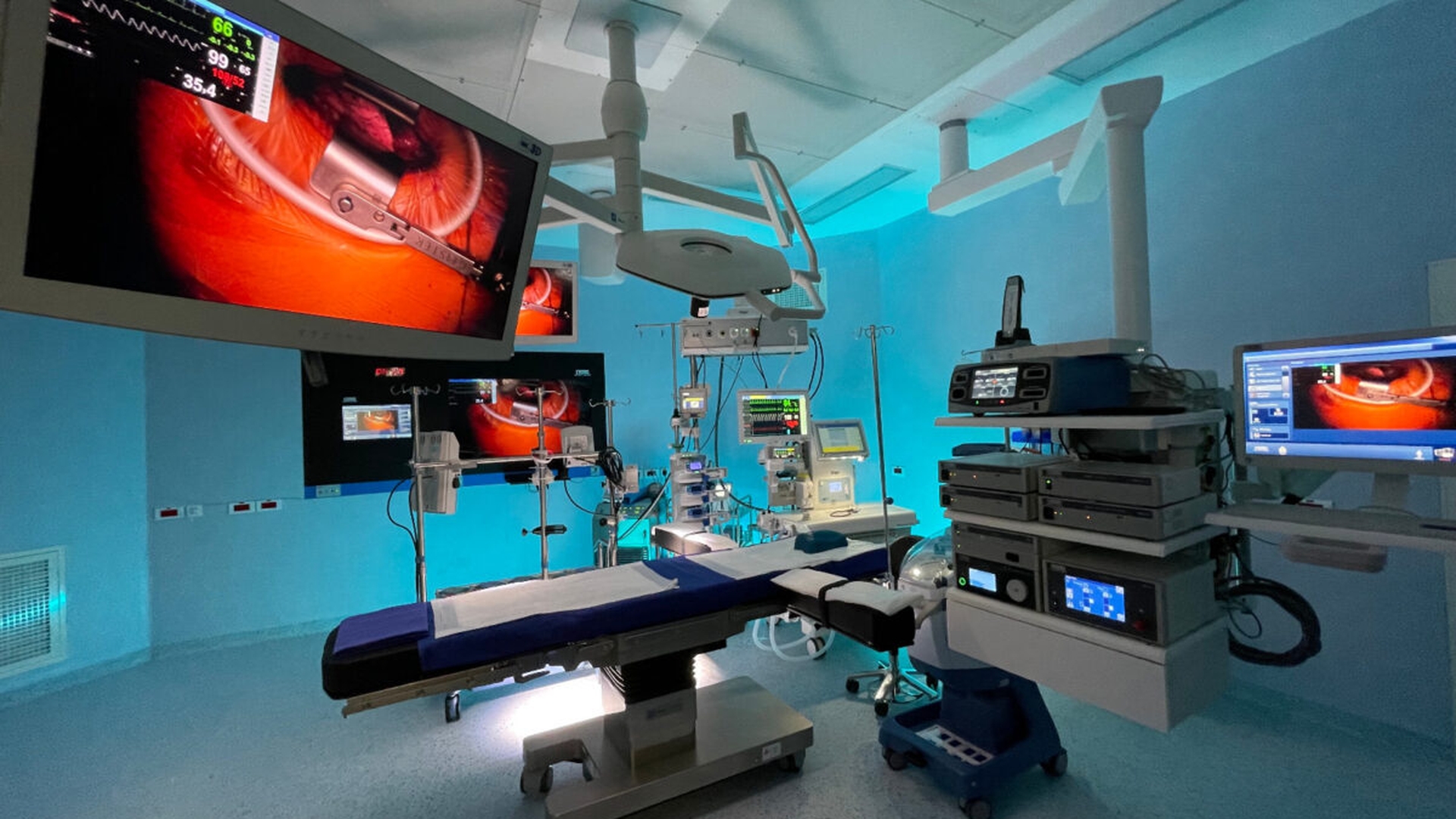 Performanță și progres în chirurgia cardiovasculară minim invazivă, la Spitalul Clinic SANADOR