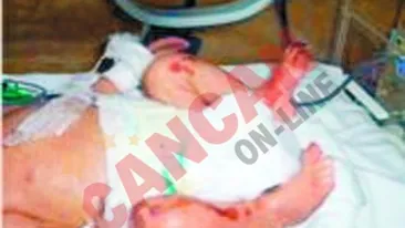 Directorul spitalului Grigore Alexandrescu: Tratamentul bebelusilor arsi la maternitatea Giulesti a costat 40.000 de euro