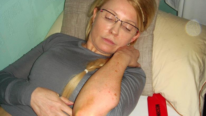 Iulia Timosenko nu a fost batuta in inchisoare, spun procurorii! Vezi cum s-a ales cu toate vanataile de pe corp!