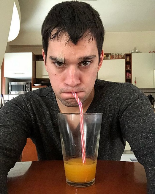 Vlad Gherman, cu fața vânătă după ce a ajuns la bisturiu: „Și-a scos alunița de la…”. Primele imagini după operația la care a fost supus tânărul actor