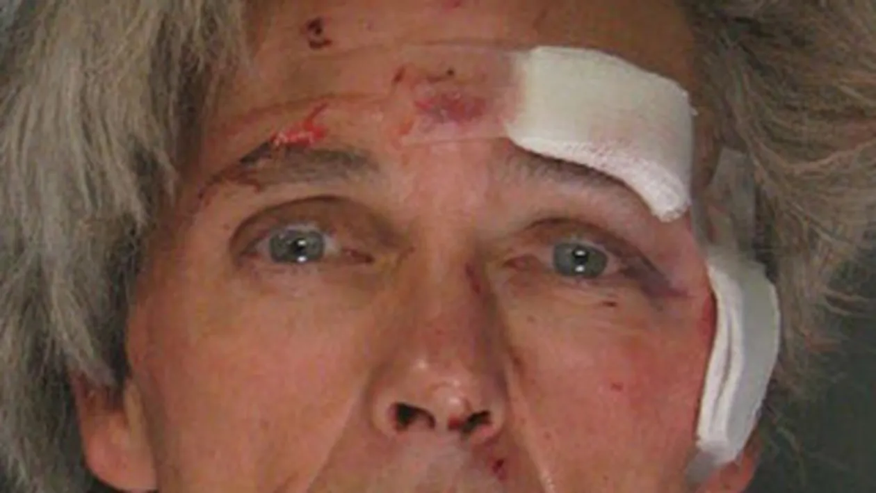 Prins dupa ce si-a uitat dintii in masina furata