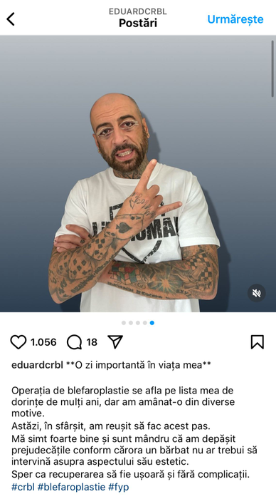 Ochii lui CRBL s-au învinețit după operație. Foto: Instagram / CRBL