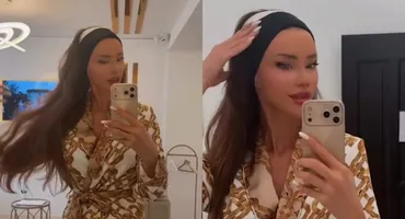 Bianca Drăgușanu s-a tunat din nou! La ce intervenție a apelat acum: ”Sunt mai mici și mai frumoase”