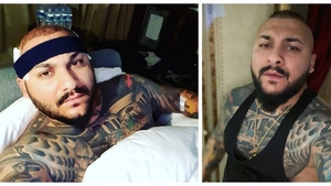 Să vezi și să nu crezi! Cum arată Dani Mocanu, după implantul de păr: „Ai dat banii de pomană, zici că ești...”