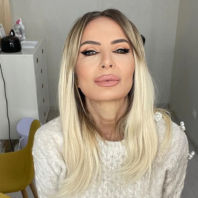 Criticată de fani pentru felul în care arată,  artista face "bilanțul" intervențiilor pe care le are!