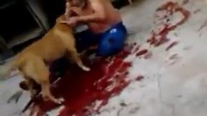 CAZ SOCANT in Brazilia! Un barbat a fost sfasiat de propriul Pitbull! Cainele i-a rupt bratul si l-a lasat pe om intr-o balta de sange!