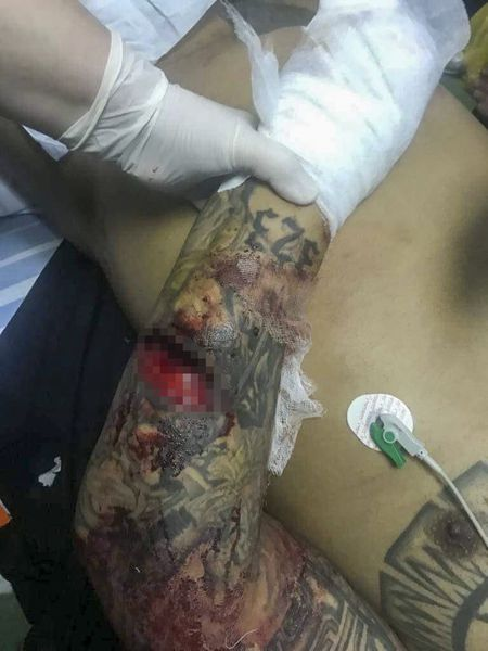 Bebino a ajuns la spital în stare gravă, după un măcel în toată regula, cu săbii și cuțite