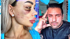 Alex Bodi, declarații stupefiante despre pozele pe care Bianca Drăgușanu și le-a făcut după ce a bătut-o: “Poate să facă 50.000 de plângeri” | VIDEO