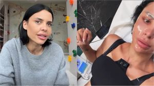 Andreea Popescu trece printr-o perioadă grea după intervenția chirurgicală. Ce mărturisire a făcut