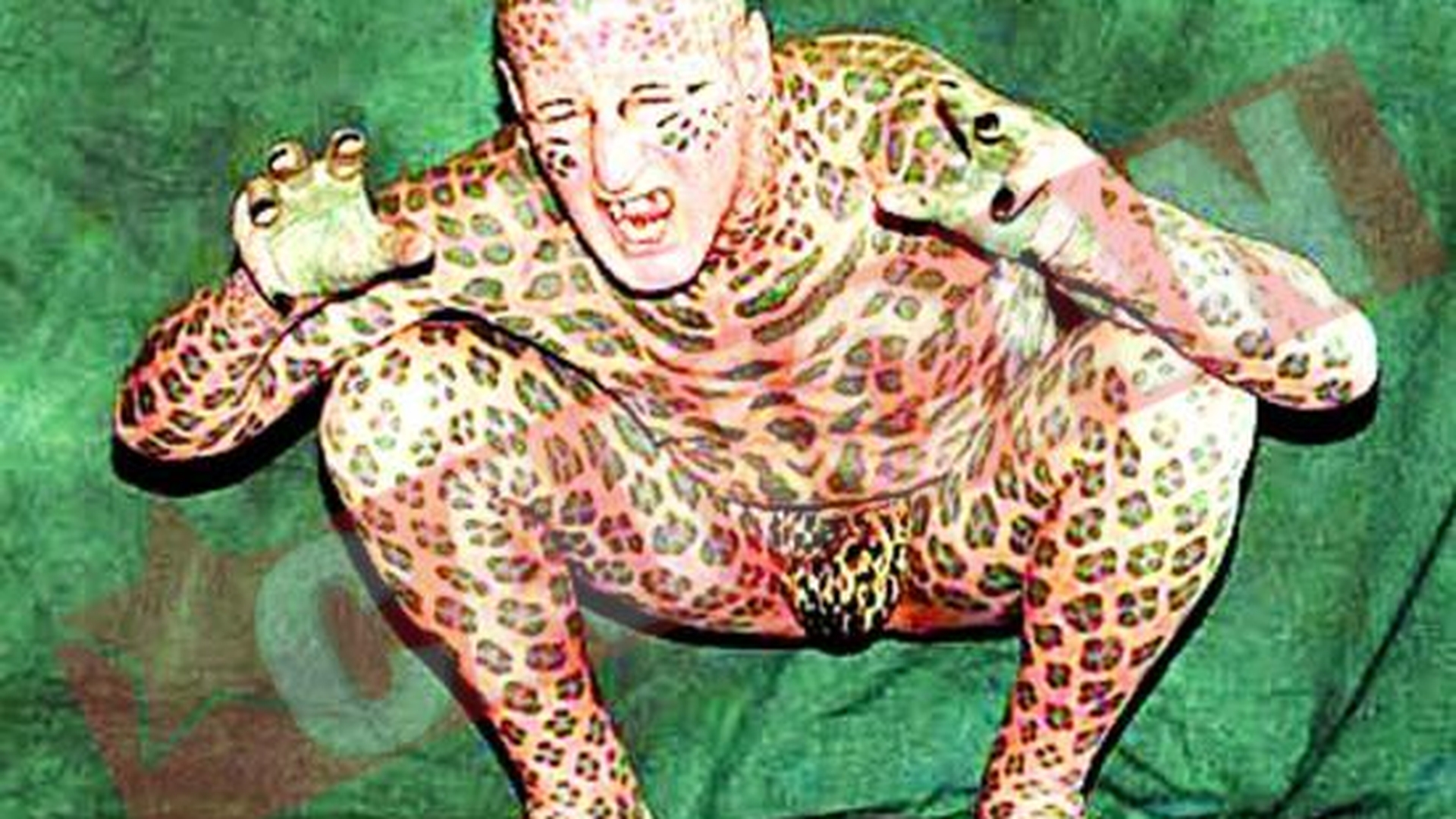 Omul-leopard traieste la azil