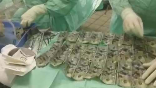 O femeie a înghiţit 7.000 de dolari! Motivul pentru care a recurs la acest gest şocant
