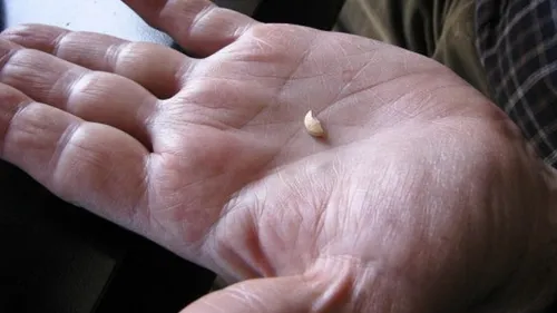 Este incredibil ce a putut sa pateasca un barbat de 70 de ani din Romania care a luat o pastila pentru potenta