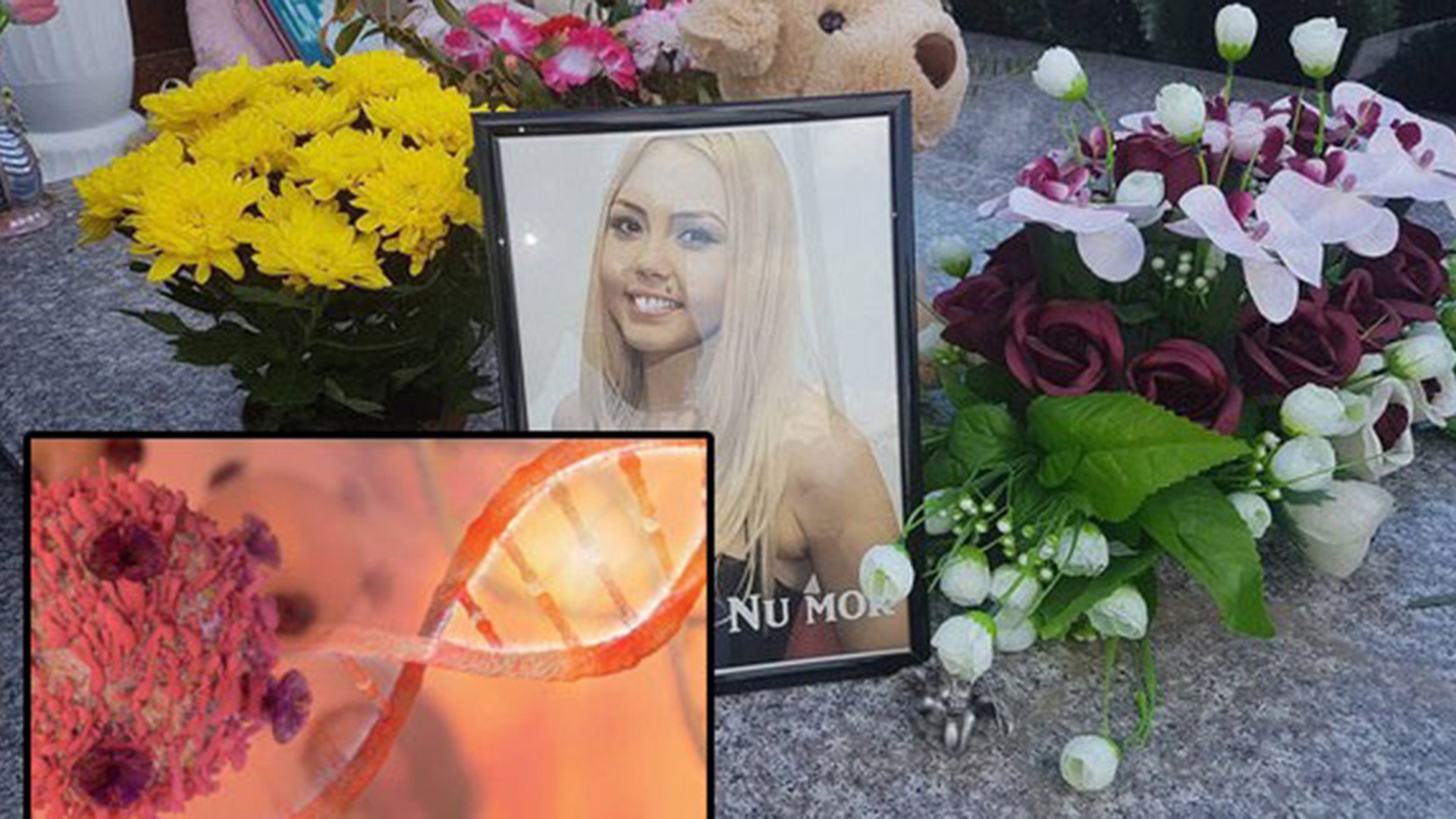 Adevărul despre boala care a ucis-o pe Denisa Răducu! 2 milioane de români suferă de această maladie fără să ştie