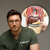 Poți pierde două treimi din ficat și el crește la loc! Dr. Mihail Pautov explică unde se termină însă „superputerea” acestui organ