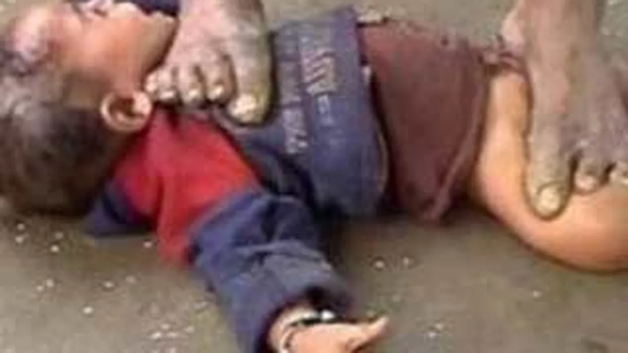 Tratament infricosator! Calca bebelusii pe gat pentru a-i trata de gripa