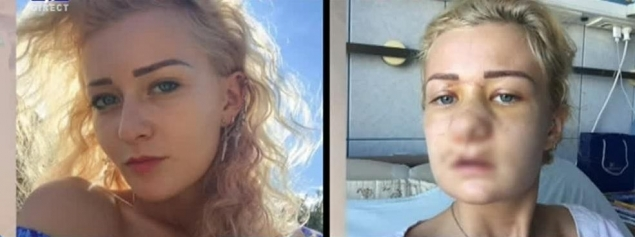 SANDRA, „blonda lui TUNCAY“, desfigurată! I-a dat cu piciorul în faţă, când pleca din club