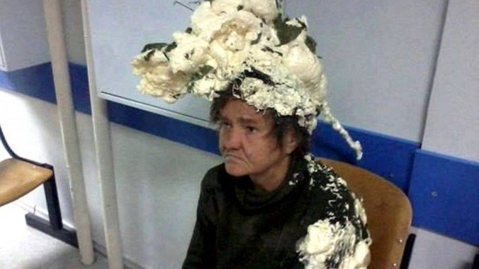 Femeia asta a ajuns la spital asa! Medicii nu stiau ce a patit, dar cand au aflat ce avea pe cap s-au ingrozit!