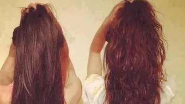 Remedii naturale pentru un matreata, scalp iritat sau cresterea parului! Cum sa ai un par superb cu un produs extrem de ieftin