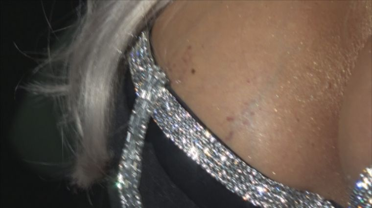 Bianca Drăgușanu, mușcată de sâni? Imagini șocante cu blondina