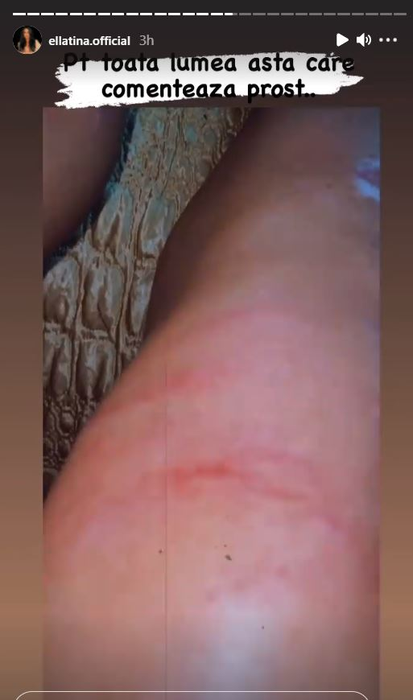 Ella de la Puterea Dragostei, declarații acide după ce a fost criticată la scurt timp după ce a fost implicată într-un grav accident: “Poate nu aveam o mână sau un picior” | FOTO