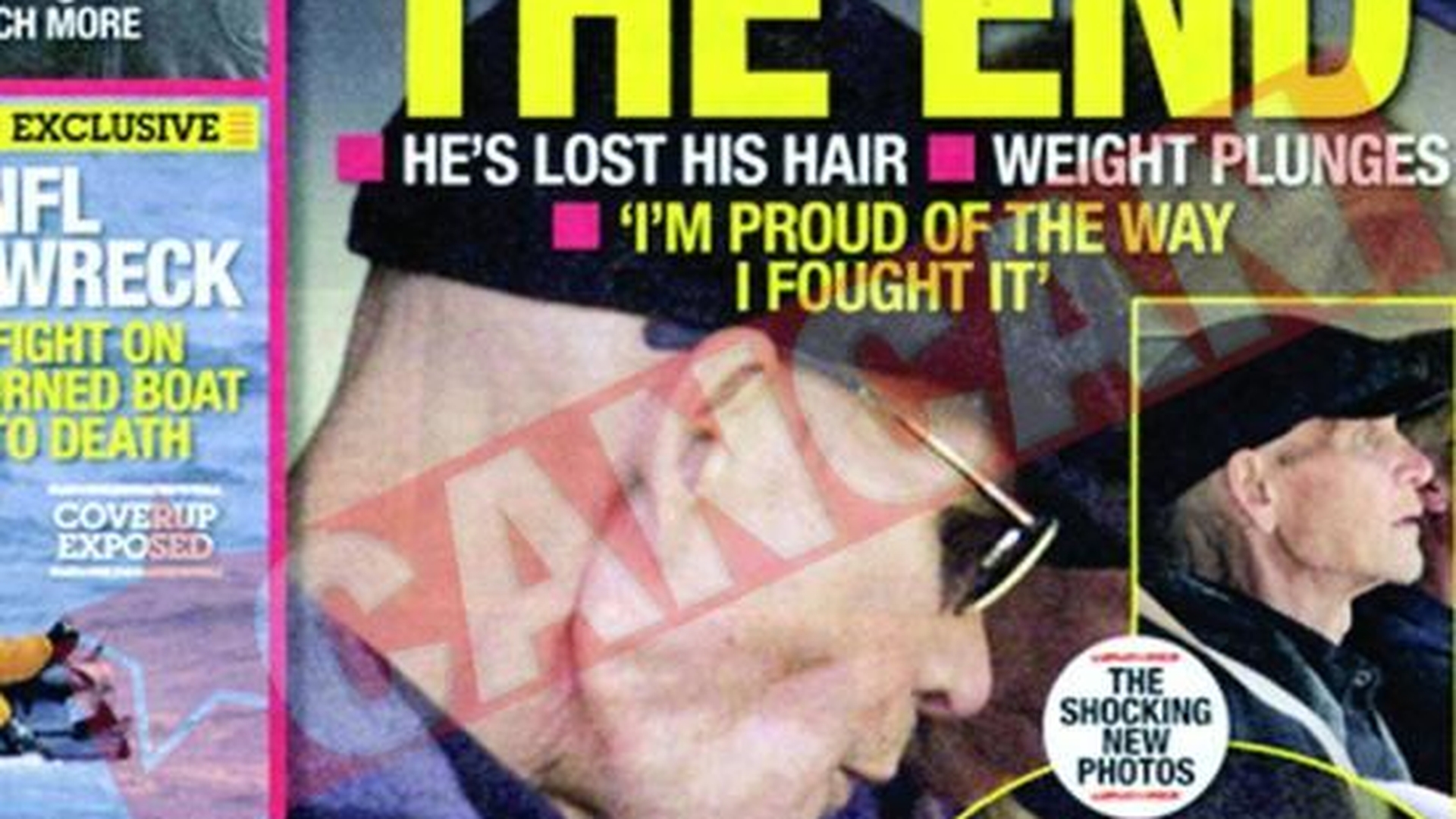 Patrick Swayze a slabit peste 40 de kilograme