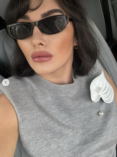 Ana Morodan, cu ochii umflați și nasul avariat, de urgență la estetician: „S-a pietrificat în față”