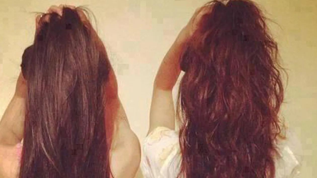 Remedii naturale pentru un matreata, scalp iritat sau cresterea parului! Cum sa ai un par superb cu un produs extrem de ieftin