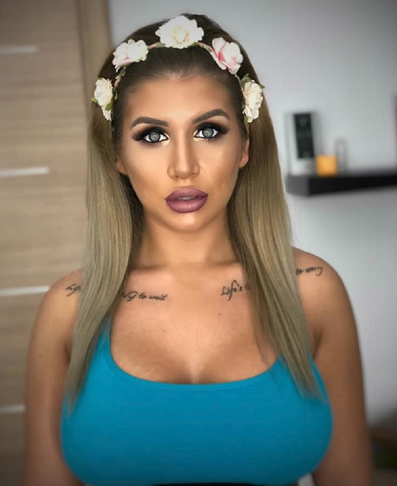 Alexandra, ex-Insula Iubirii, fotografie șocantă pe patul de spital: ”Mă simțeam călcată de tren…”