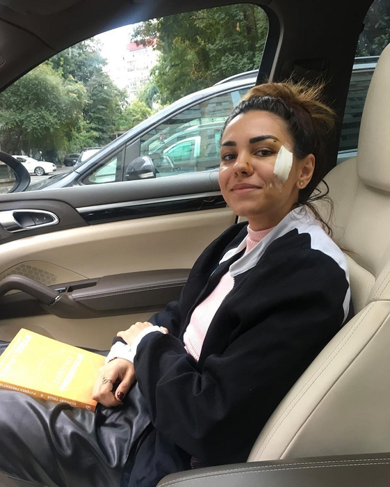 După accidentul oribil în care a fost implicată, Mira a renunţat la haine şi… Cum s-a fotografiat artista în baie