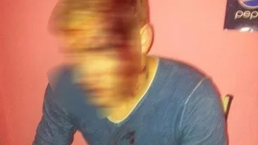 Imagini SOCANTE! Un fotbalist englez a fost lovit cu TOPORUL in cap. Afla cine este de vina